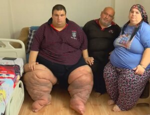 Sadece iki yılda bu hale geldi! Evden bile çıkamıyor