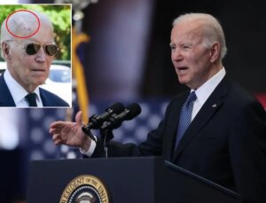 Eski ABD Başkanı Joe Biden cilt kanseri ameliyatı oldu