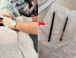 Genç kadının midesinden iki adet kalem çıkarıldı