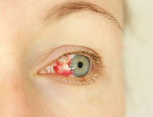 Gözde kanama ile başlayan gizemli virüs yayılmaya başladı: 8 ölü