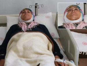 Tek ameliyatla sağlığına kavuştu, 15 yıl sonra ilk defa gülümseyebilecek