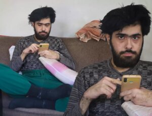 3 yıldır tırnaklarını kesmeyen ve duş almayan gencin eski hali ortaya çıktı