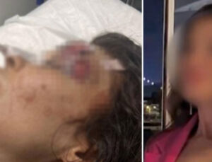 Sibel’i yumrukla darp eden boksör bıçaklamıştı… Kan donduran detaylar ortaya çıktı!