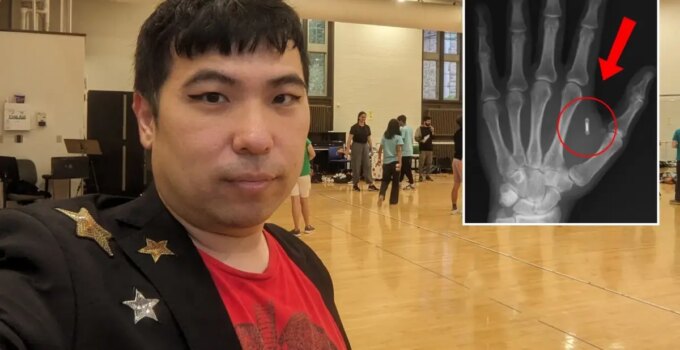 Akılalmaz hata! Eline yerleştirdiği mikroçipin şifresini unuttu