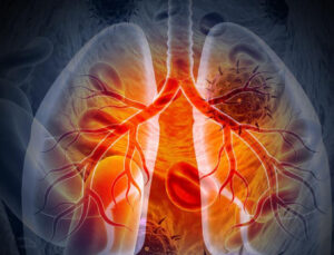 Dikkat! Sigara ile birlikte kullanmayın! Akciğer kanseri riskini 4 kat artırıyor