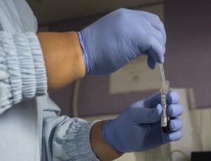 DSÖ: 2024’te 1.3 milyon kişi AIDS hastalığına yakalandı