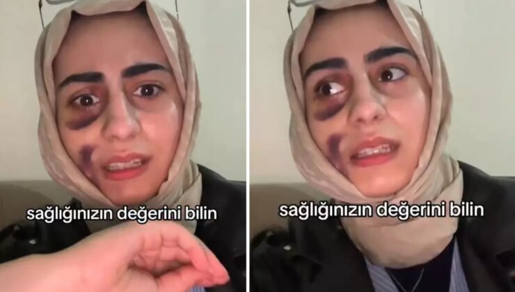 Stajyer doktora tedavi olan kadın video çekip isyan etti