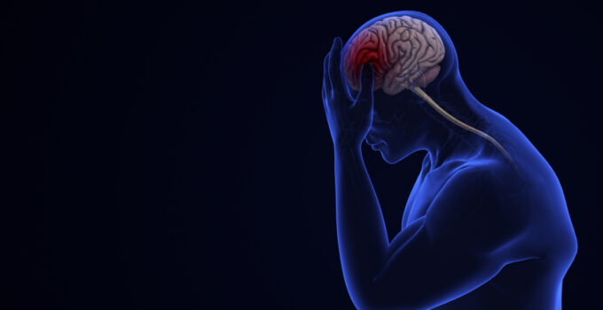 Yanlış ilaç ve alternatif yöntemler migreni kronikleştiriyor