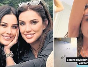 Yolunmuş saçlarını paylaştı