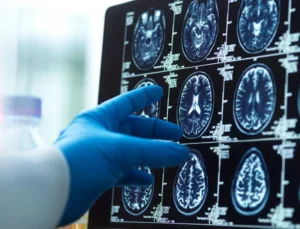 Zihin Egzersizleri Hafızayı Güçlendiriyor: Demans Riski Kayda Değer Oranda Düşüyor