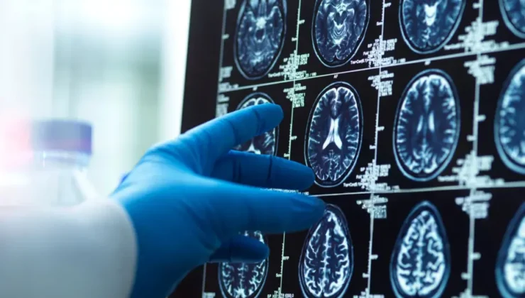 Zihin Egzersizleri Hafızayı Güçlendiriyor: Demans Riski Kayda Değer Oranda Düşüyor