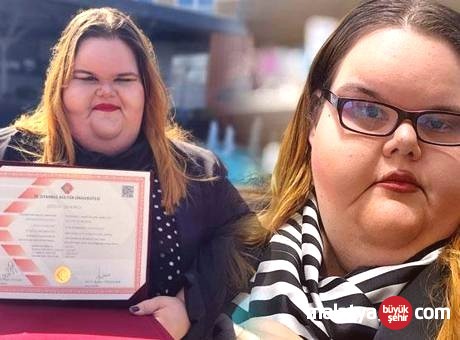 Zorbalıkla Mücadele Eden Genç Psikoloji Okudu