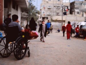 Savaşın Gölgesinde Kaybolan Çocukluk: Bir El ve Bir Diz Kapağının Bedeli