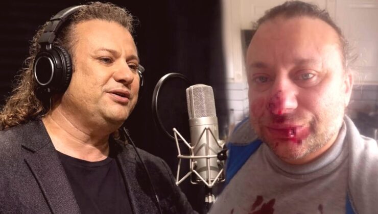 Ses Sanatçısı Onur Akay Et Yiyen Bakteriyle Mücadele Ediyor