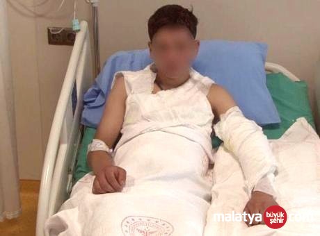 Sosyal medya akımları gençlerin hayatını karartıyor: Kolonya ile oynarken alevler içinde kaldı
